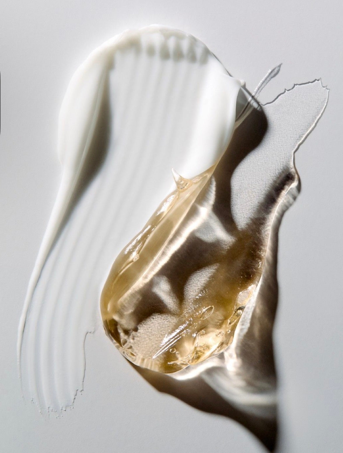 Treatment (Up To $70)